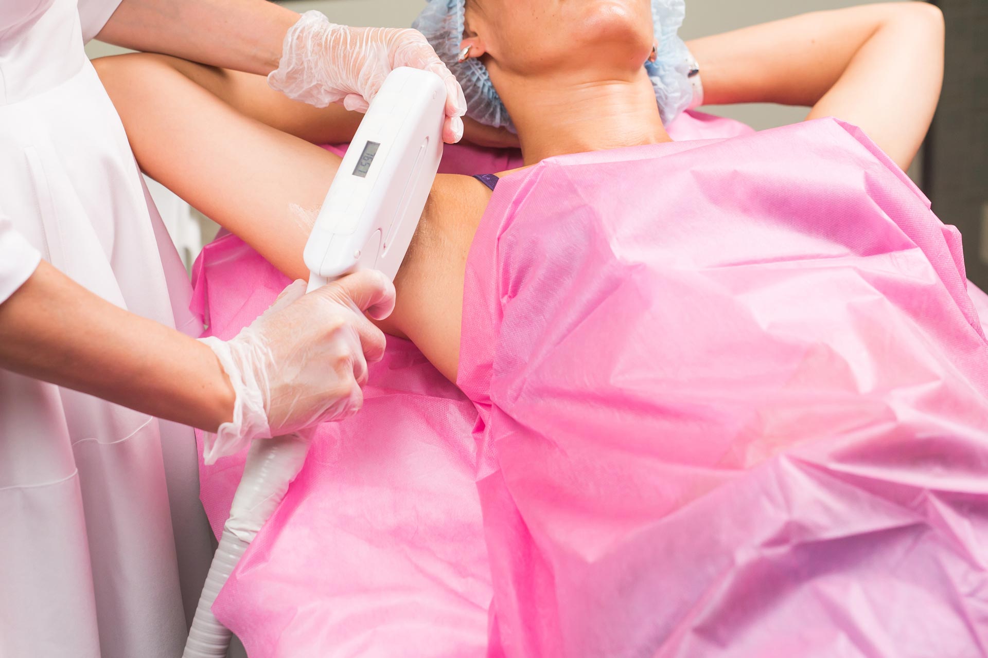6 Benefits Of Laser Hair Removal